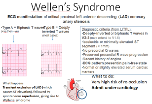 Wellen's syndrome